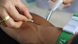 arm of a donor donating blood 