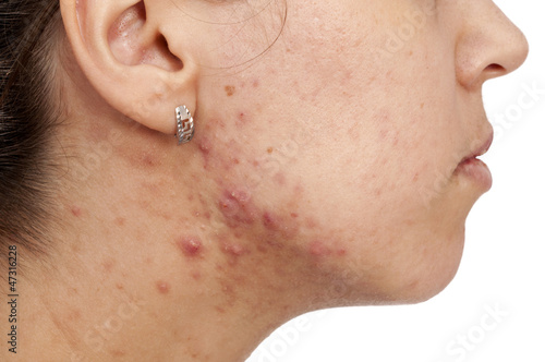 Photo: Skin problems Skin problems