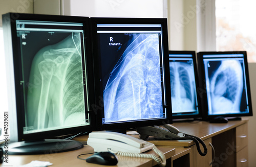 Photo: Radiography of human body parts Radiography of human body parts