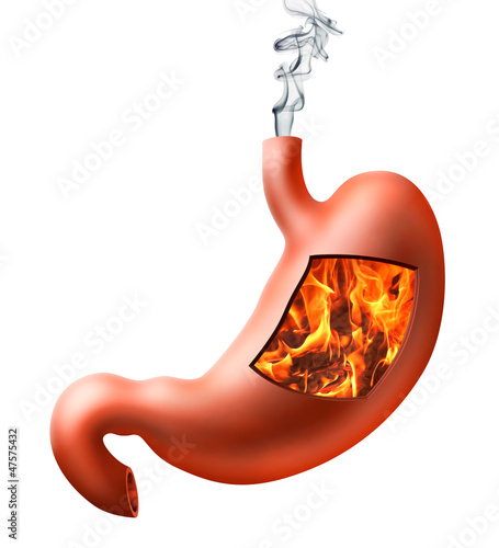 Illustration: Stomach heartburn Stomach heartburn