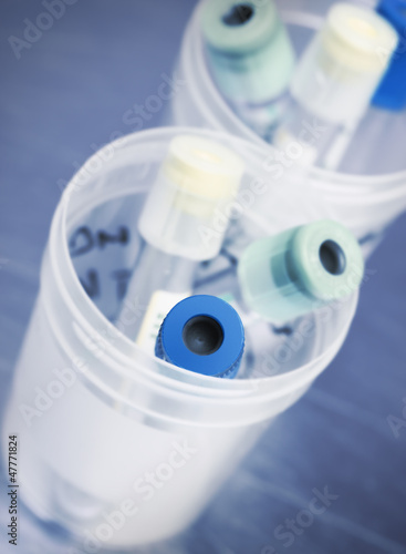 Photo: Plastic test tube. Laboratory. Plastic test tube. Laboratory.