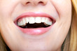 closeup of the laughing of a young woman
