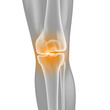 Knie-Schmerzen - Röntgenbild - 3D Grafik