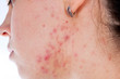 Problems with skin