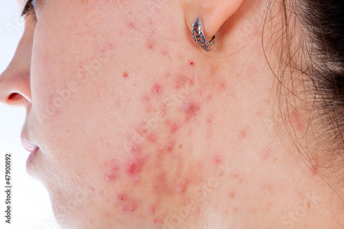 Photo: Problems with skin Problems with skin