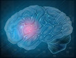 Vector: Brain with pain Brain with pain