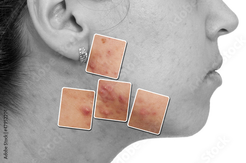 Photo: Skin problems Skin problems