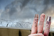 Finger is captive