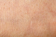Human skin