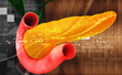 Pancreas