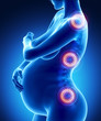 Pregnancy spine problem concept
