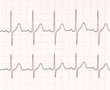cardiogram