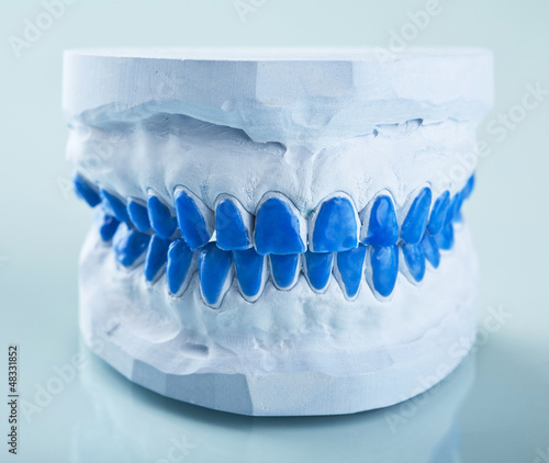 Photo: individual plaster dental molds to make trays individual plaster dental molds to make trays