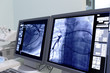 Foto: Monitor screen in radiology. Monitor screen in radiology.