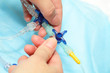 Manipulation of the plastic valve. Medicine. Science.