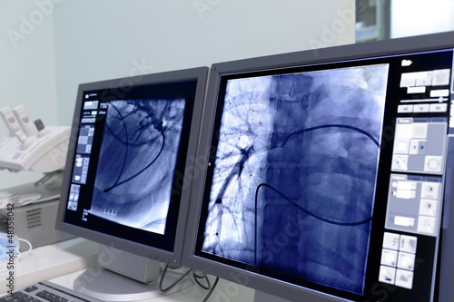 Photo: Monitor screen in radiology. Monitor screen in radiology.