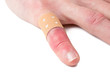 Wunde am Finger