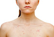 Skin problems