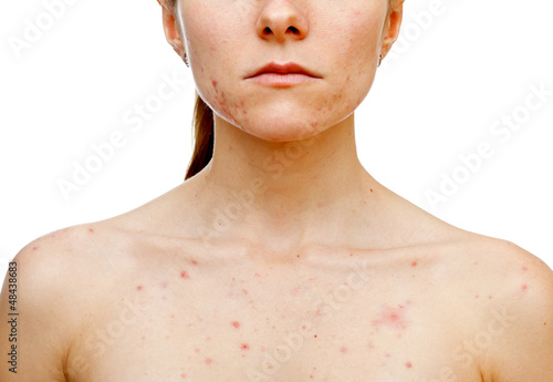 Photo: Skin problems Skin problems