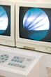Foto: Röntgenbilder einer Hand Röntgenbilder einer Hand