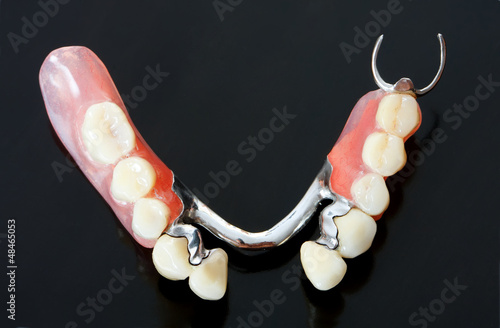 Photo: Part of a skeletal prosthesis - part of a series Part of a skeletal prosthesis - part of a series