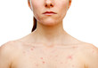 Skin problems