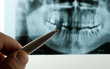 Dental X-ray
