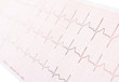 cardiogram