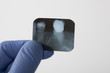 looking a x-ray of tooth