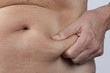 female person checking her belly fat
