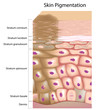 Formation of uneven skin tone, eps8