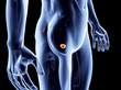 Prostata