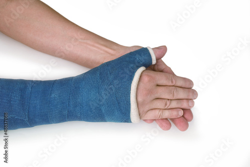 Photo: Broken wrist, arm with a blue fiberglass cast on a white backgro Broken wrist, arm with a blue fiberglass cast on a white backgro