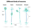 Vector: Different kinds of neurons Different kinds of neurons