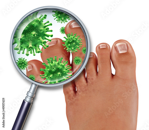Illustration: Foot Fungus Foot Fungus