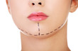 Woman marked out for cosmetic surgery.
