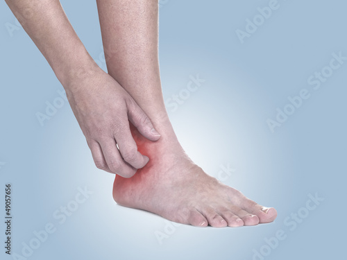 Photo: Women scratch itchy ankle with hand. Women scratch itchy ankle with hand.