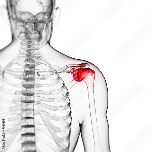 Illustration: 3d rendered illustration of a painful shoulder 3d rendered illustration of a painful shoulder