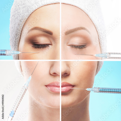 Photo: A collage of parts of a female face on a botox procedure A collage of parts of a female face on a botox procedure
