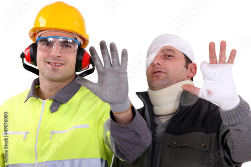 Photo: Injured tradesman comparing his hand to a healthy colleague Injured tradesman comparing his hand to a healthy colleague