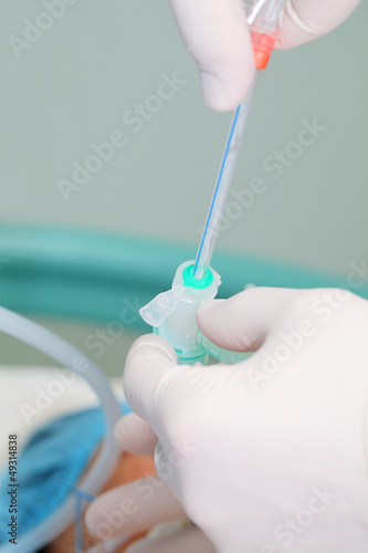 Photo: sanation of trachea. Working with patients in the ICU. sanation of trachea. Working with patients in the ICU.
