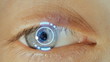 Eye