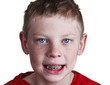 Boy with braces