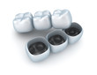 Illustration: Artificial tooth crowns. Artificial tooth crowns.