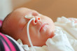 premature infant
