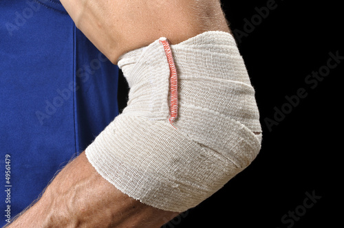 Photo: Elbow injury Elbow injury