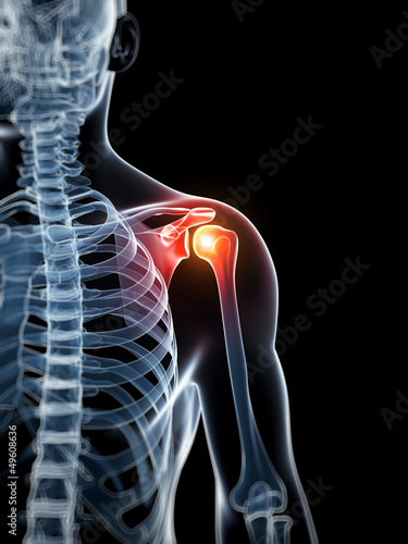 Illustration: 3d rendered illustration - painful shoulder 3d rendered illustration - painful shoulder