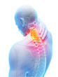 3d rendered illustration - painful neck
