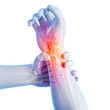 3d rendered illustration - painful arm/wrist