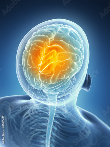 Illustration: 3d rendered illustration - headache 3d rendered illustration - headache